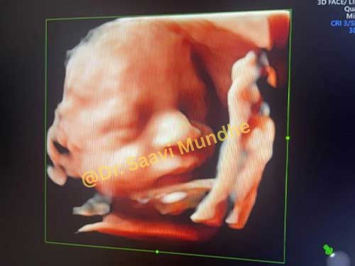 Growth Scans